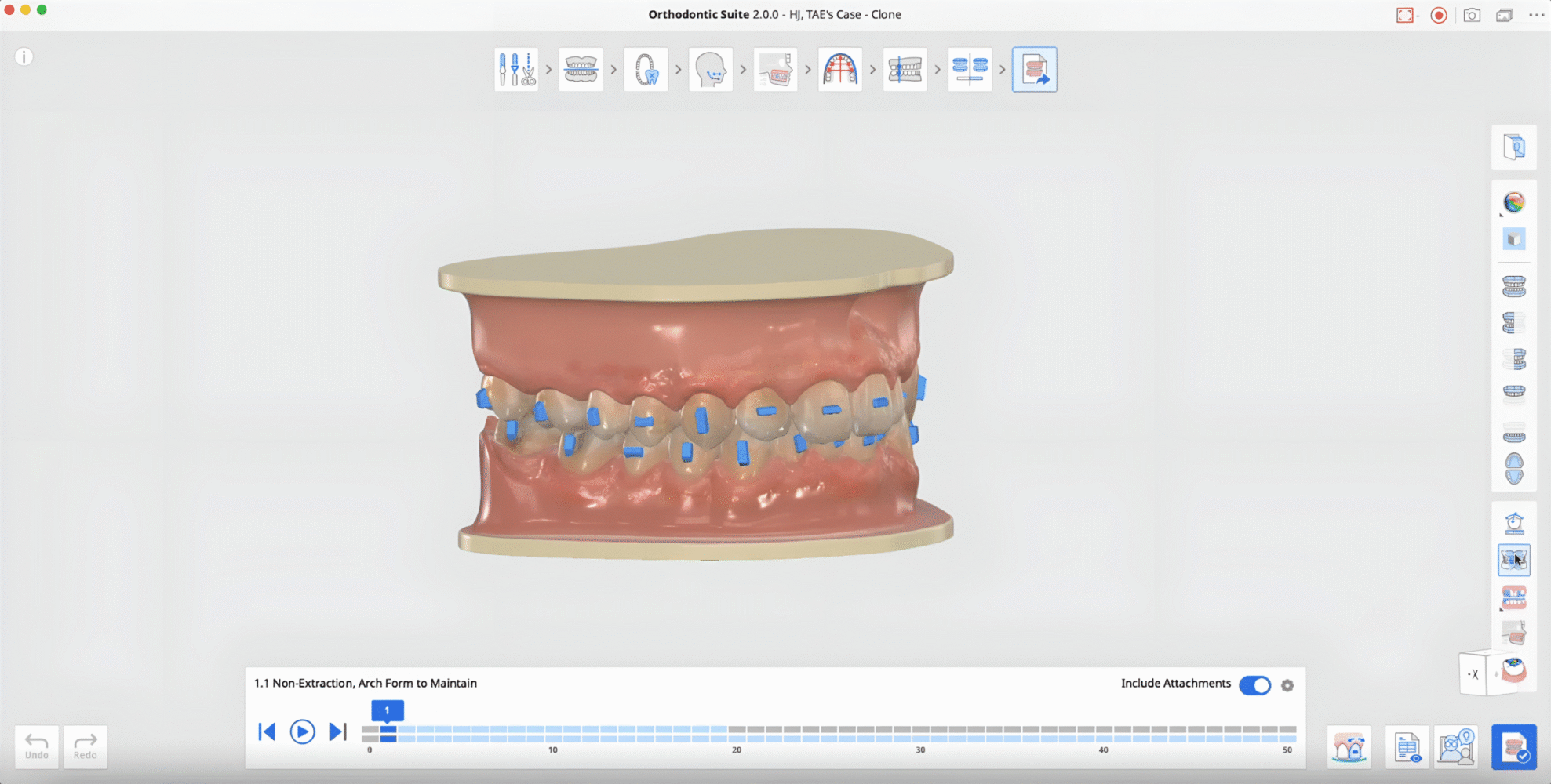 medit-orthodontic-suite-21-scaled.png
