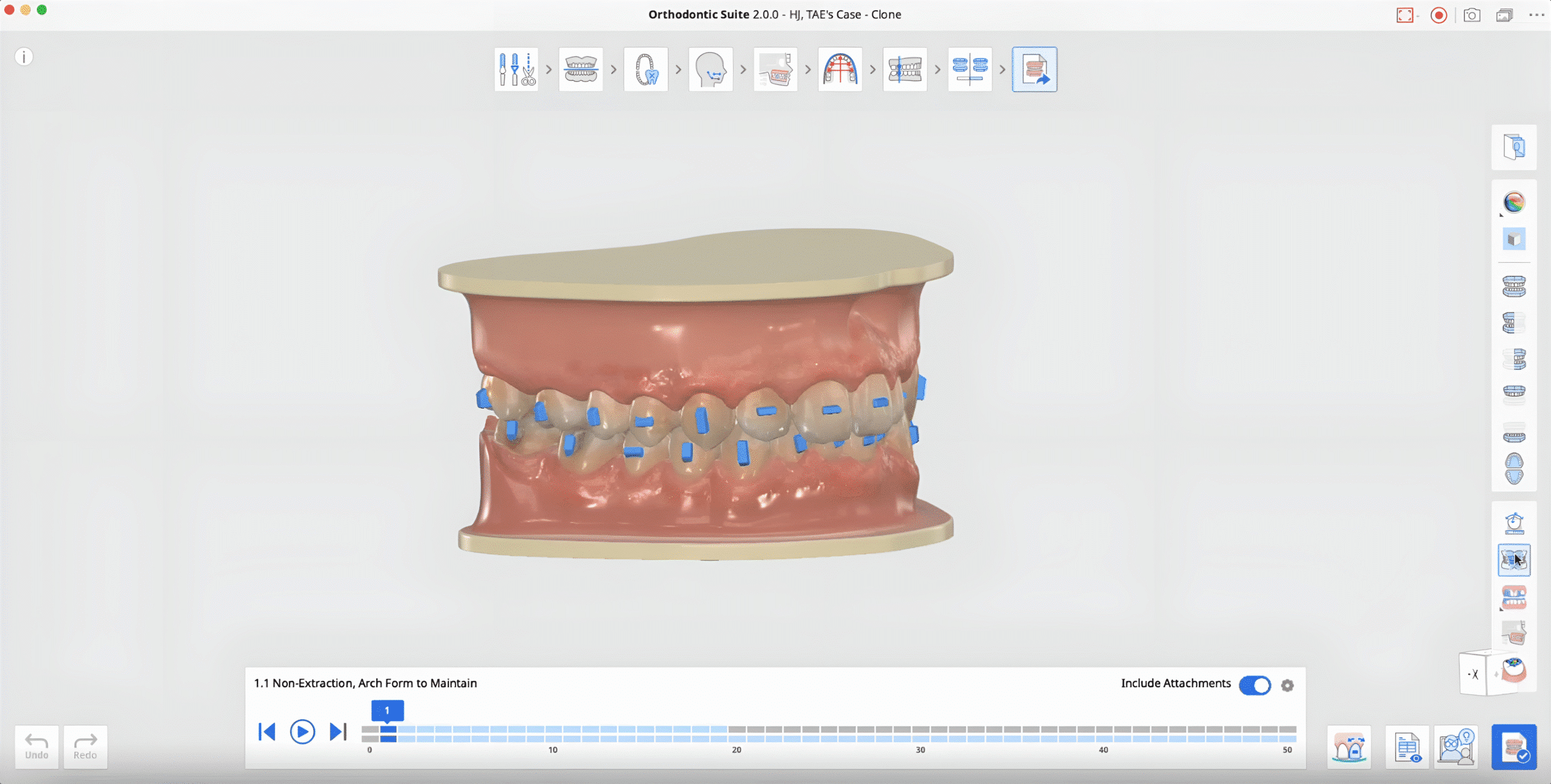 medit-orthodontic-suite-21-scaled.png