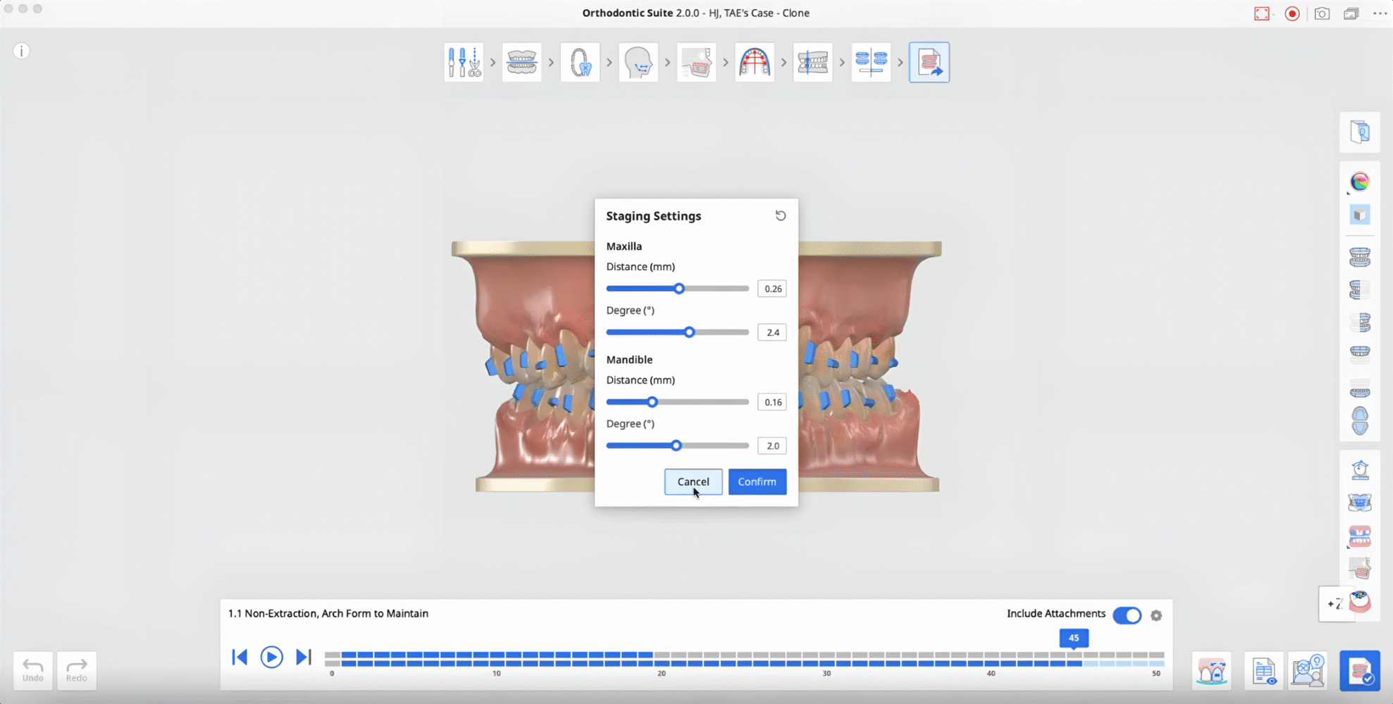 medit-orthodontic-suite-23-scaled.png