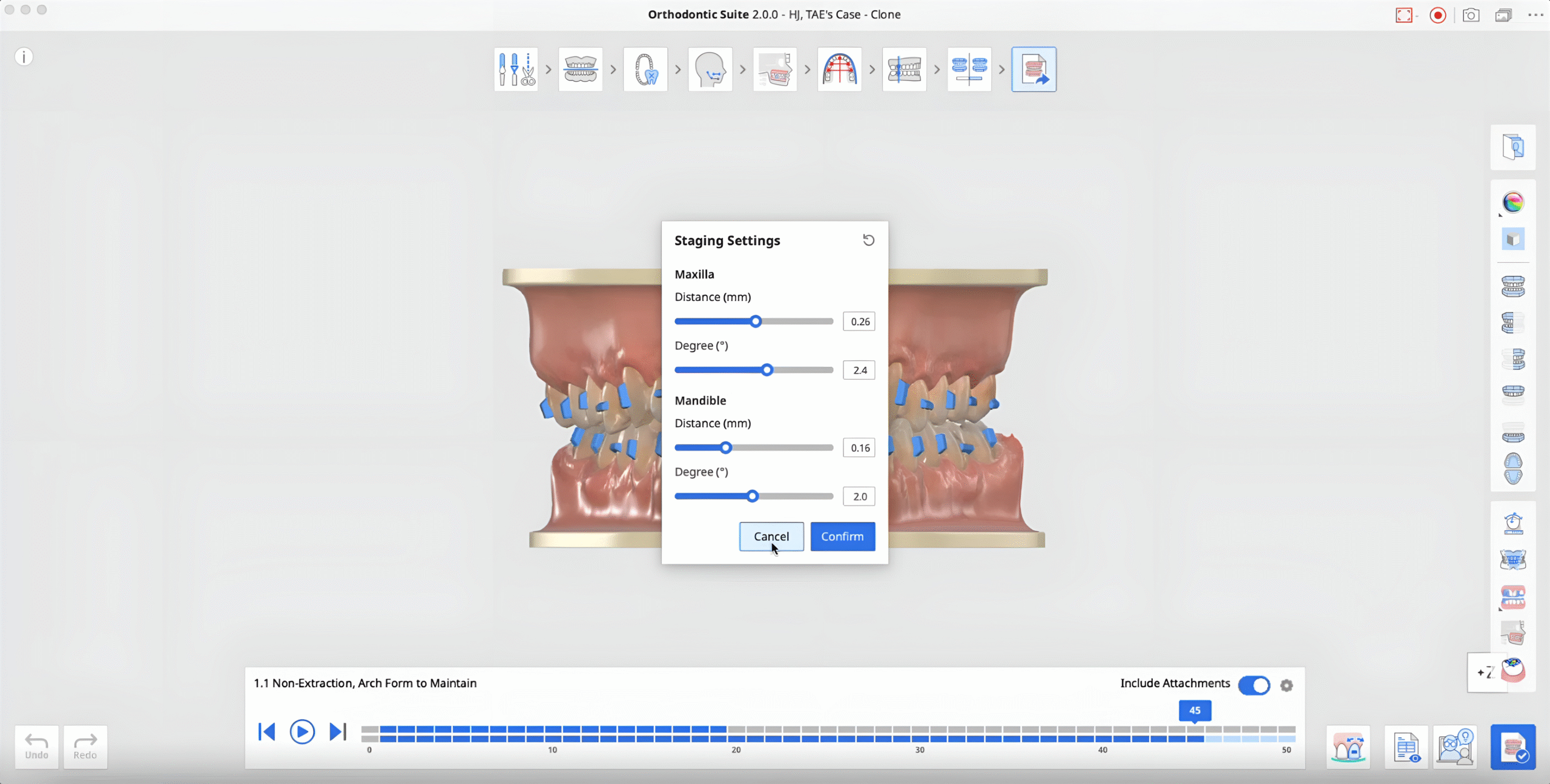 medit-orthodontic-suite-23-scaled.png
