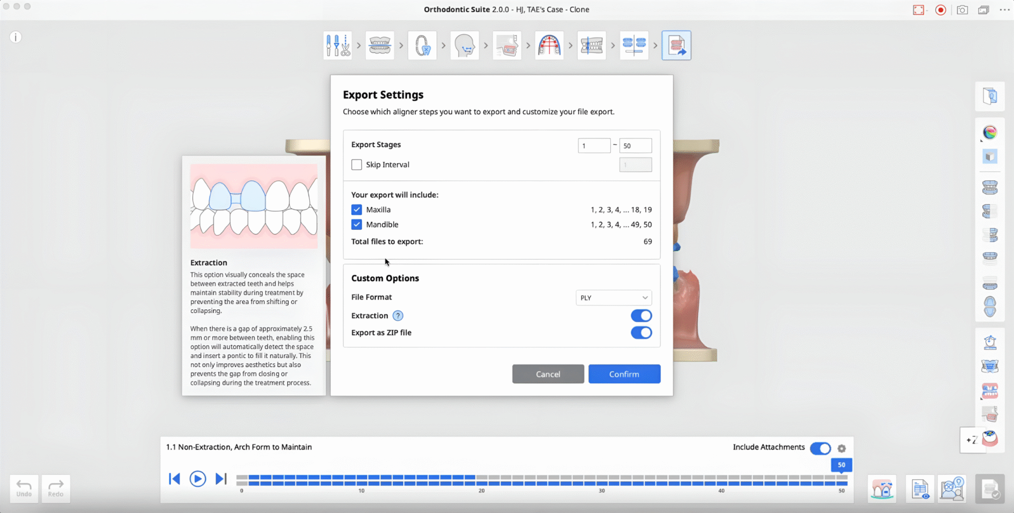 medit-orthodontic-suite-3-scaled.png