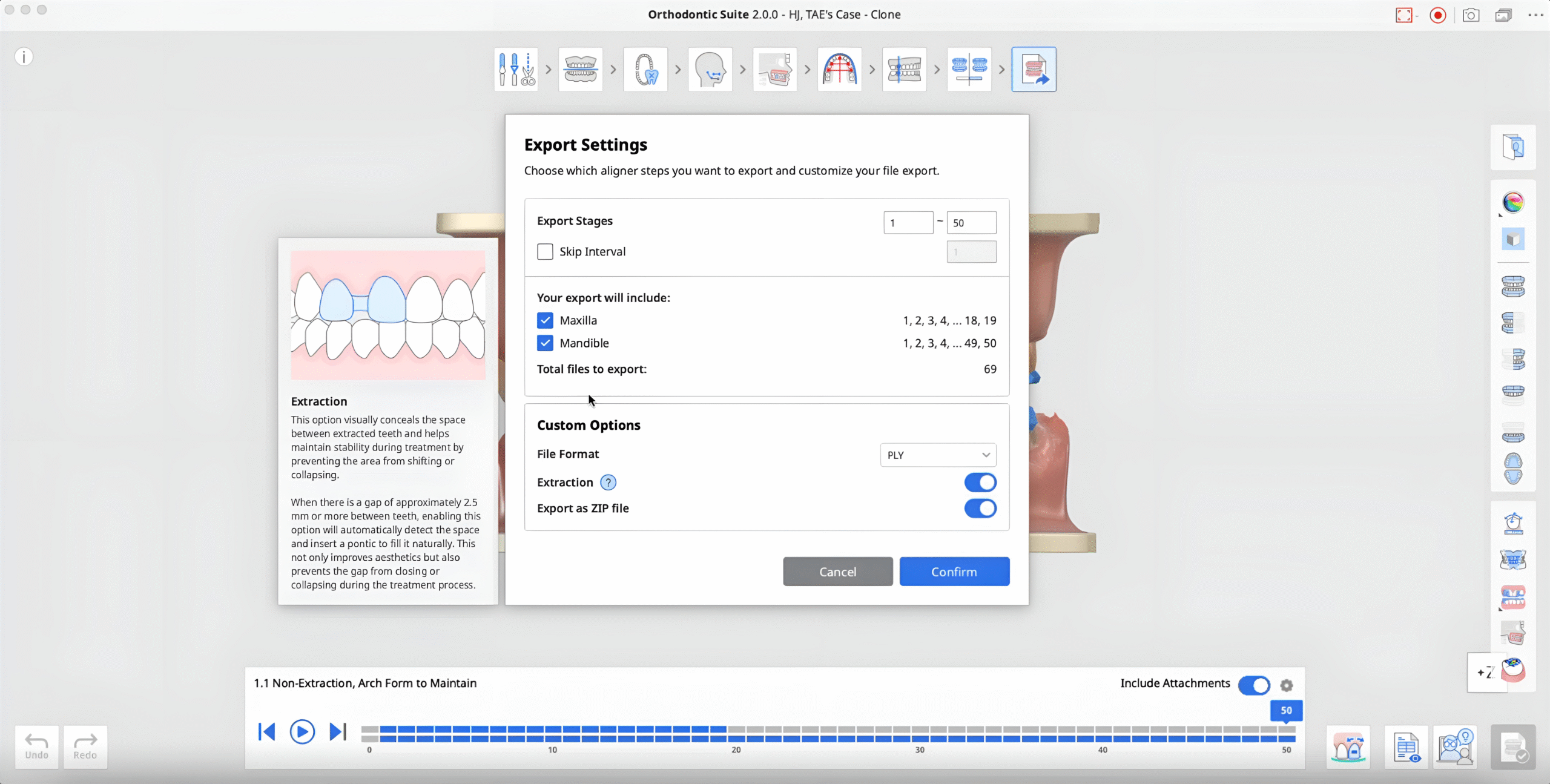 medit-orthodontic-suite-3-scaled.png