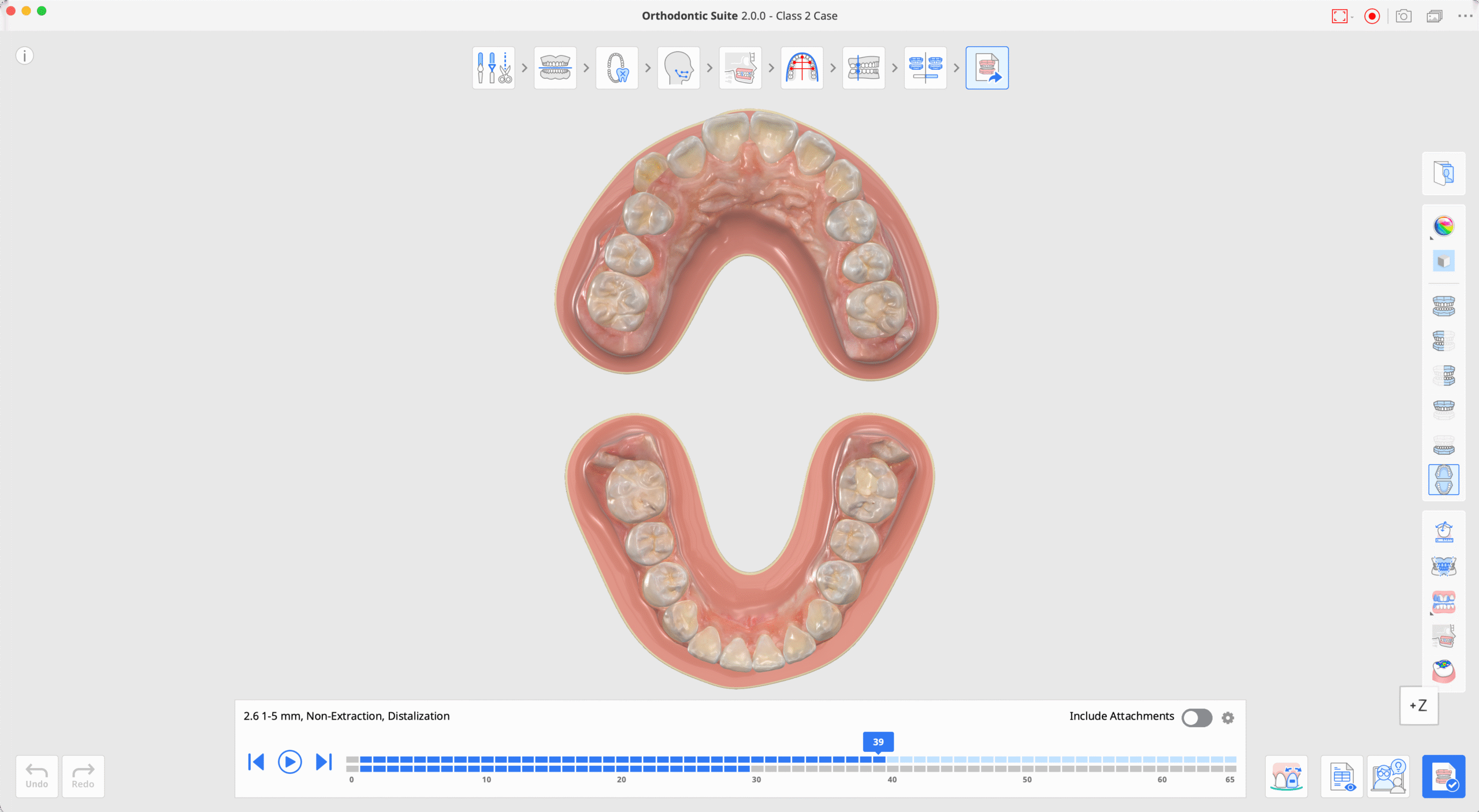 mos-walkthrough-444-1-scaled.png