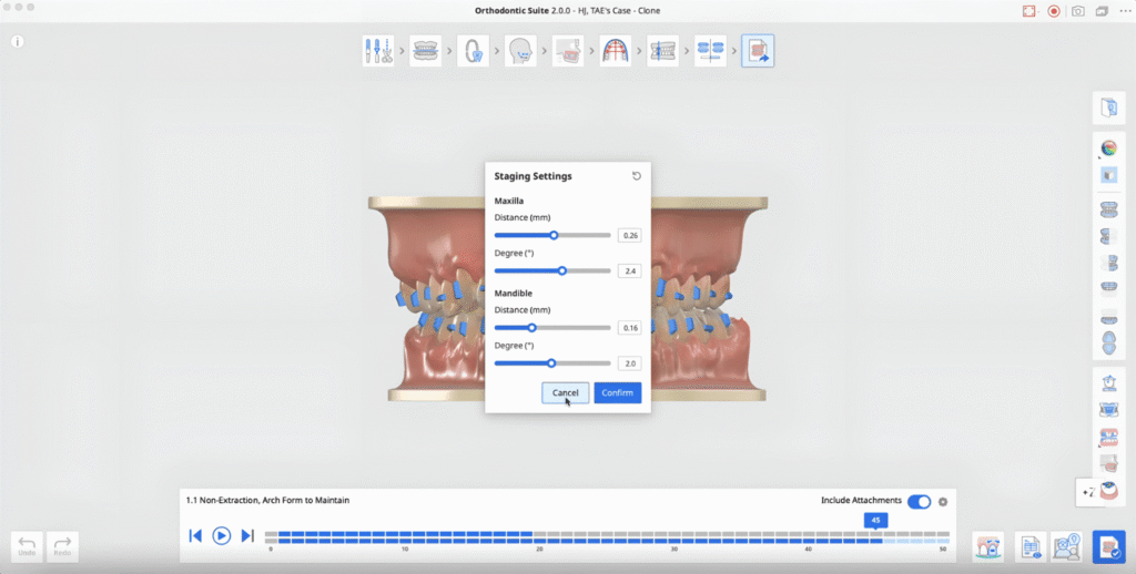 Staging Settings dialog over a 3D dental model showing Maxilla and Mandible distance and degree sliders, with Cancel and Confirm buttons.